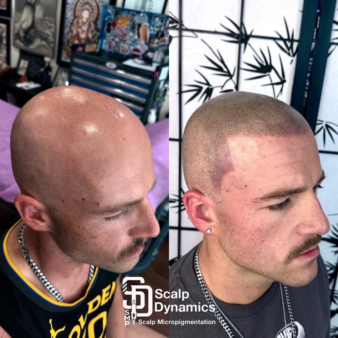 ScalpDynamics work 9