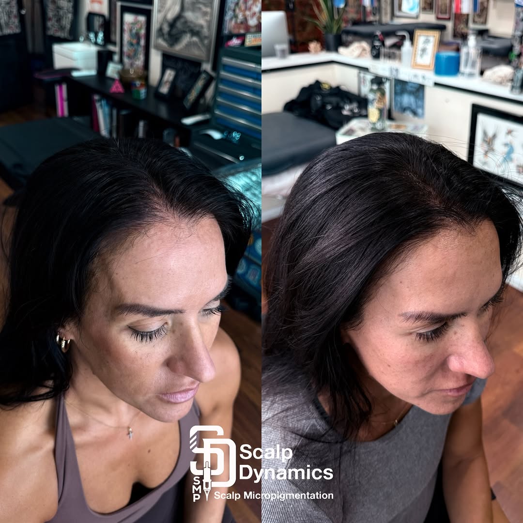 ScalpDynamics work 8